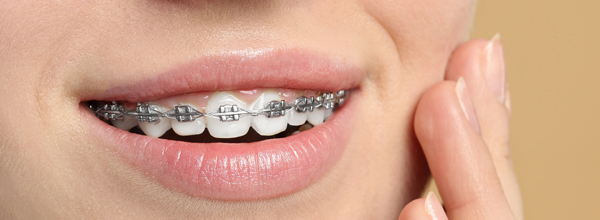Smiling woman with braces